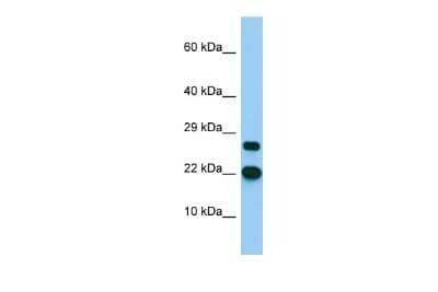 Western Blot: BTF3L4 Antibody [NBP2-84526] - Host: Rabbit. Target Name: BTF3L4. Sample Type: MCF7 Whole Cell lysates. Antibody Dilution: 1.0ug/ml