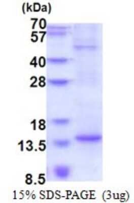 SDS-Page: BTF3L4 Recombinant Protein [NBP2-51577] - 15% SDS Page (3 ug)