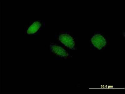 Immunocytochemistry/Immunofluorescence: BTG4 Antibody [H00054766-B01P] - Analysis of purified antibody to BTG4 on HeLa cell. (antibody concentration 10 ug/ml)