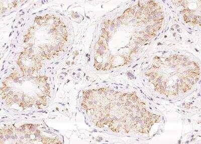 Immunohistochemistry-Paraffin: BTG4 Antibody [NBP3-05926] - Staining of human BTG4 in human testis with rabbit polyclonal antibody at 1:100 dilution.