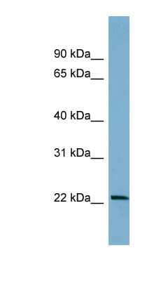 Western Blot: BTG4 Antibody [NBP1-58173] - Human Brain lysate, concentration 0.2-1 ug/ml.