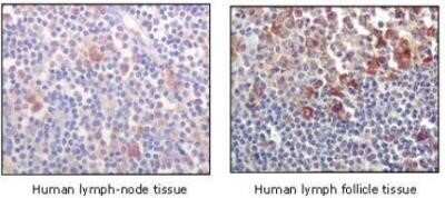 Immunohistochemistry-Paraffin: BTK Antibody (7F12H4) - Azide and BSA Free [NBP2-80605] - Immunohistochemical analysis of paraffin-embedded human lymph-node tissues (left) and human lymph follicle tissues (right), showing cytoplasmic and membrane localization using BTK mouse mAb with DAB staining. Image from the standard format of this antibod