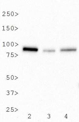 Western Blot: BTK Antibody (7F12H4) - Azide and BSA Free [NBP2-80605] - Analysis of BTK expression in 2) Raji, 3) A431 whole cell lysates and 4) human tonsil tissue extract. Image from the standard format of this antibody.