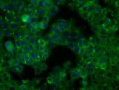 Immunocytochemistry/Immunofluorescence: BTK Antibody (OTI3A2) - Azide and BSA Free [NBP2-70291] - Staining of HT29 cells using anti-BTK mouse monoclonal antibody.