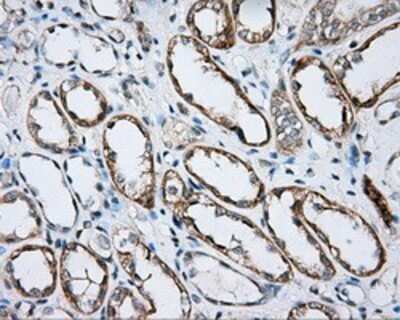 Immunohistochemistry: BTK Antibody (OTI3A2) - Azide and BSA Free [NBP2-70291] - Staining of paraffin-embedded Kidney tissue using anti-BTK mouse monoclonal antibody.