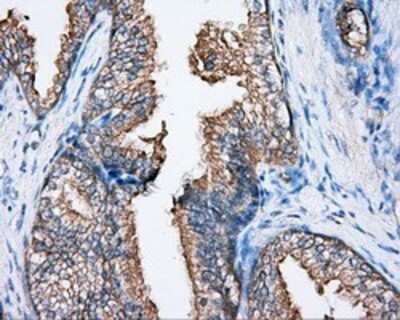 Immunohistochemistry: BTK Antibody (OTI3A2) - Azide and BSA Free [NBP2-70291] - Staining of paraffin-embedded prostate tissue using anti-BTK mouse monoclonal antibody.