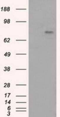 Western Blot: BTK Antibody (OTI3A2) - Azide and BSA Free [NBP2-70291] - HEK293T cells were transfected with the pCMV6-ENTRY control (Left lane) or pCMV6-ENTRY BTK (Right lane) cDNA for 48 hrs and lysed. Equivalent amounts of cell lysates (5 ug per lane) were separated by SDS-PAGE and immunoblotted with anti-BTK.