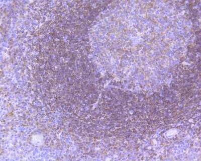 Immunohistochemistry-Paraffin: BTK Antibody (SN69-07) [NBP2-67675] - Immunohistochemical analysis of paraffin-embedded human tonsil tissue using anti-BTK antibody. The section was pre-treated using heat mediated antigen retrieval with sodium citrate buffer (pH 6.0) for 20 minutes. The tissues were blocked in 5% BSA for 30 minutes at room temperature, washed with ddH2O and PBS, and then probed with the primary antibody (1/50) for 30 minutes at room temperature. The detection was performed using an HRP conjugated compact polymer system. DAB was used as the chromogen. Tissues were counterstained with hematoxylin and mounted with DPX.