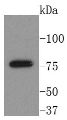 Western Blot: BTK Antibody (SN69-07) [NBP2-67675] - Analysis of BTK on Raji cells lysates using anti-BTK antibody at 1/1,000 dilution.