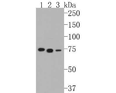 Western Blot: BTK Antibody (SN69-07) [NBP2-67675] - Western blot analysis of BTK on different lysates. Proteins were transferred to a PVDF membrane and blocked with 5% BSA in PBS for 1 hour at room temperature. The primary antibody (1/500) was used in 5% BSA at room temperature for 2 hours. Goat Anti-Rabbi