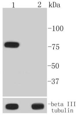 Western Blot: BTK [p Tyr223] Antibody (ST51-05) [NBP2-67526] - Analysis of Phospho-BTK(Y223) on different lysates using anti-Phospho-BTK(Y223) antibody at 1/1,000 dilution. Positive control: Lane 1: K562 cells treated with pervanadate Lane 2: Untreated K562 cell lysate