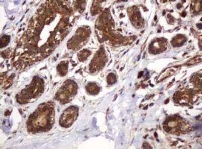 Immunohistochemistry: BTLA/CD272 Antibody (OTI2E4) - Azide and BSA Free [NBP2-72427] - Analysis of Human breast tissue. (Heat-induced epitope retrieval by 10mM citric buffer, pH6.0, 120C for 3min)