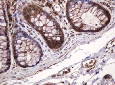 Immunohistochemistry: BTLA/CD272 Antibody (OTI2E4) - Azide and BSA Free [NBP2-72427] - Analysis of Human colon tissue. (Heat-induced epitope retrieval by 10mM citric buffer, pH6.0, 120C for 3min)