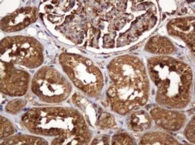 Immunohistochemistry: BTLA/CD272 Antibody (OTI2E4) - Azide and BSA Free [NBP2-72427] - Analysis of Human Kidney tissue. (Heat-induced epitope retrieval by 10mM citric buffer, pH6.0, 120C for 3min)