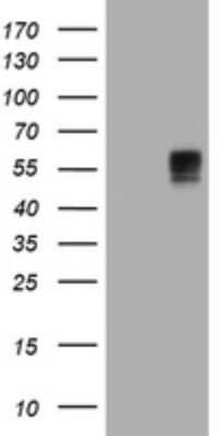 Western Blot: BTLA/CD272 Antibody (OTI2E4) - Azide and BSA Free [NBP2-72427] - Analysis of HEK293T cells were transfected with the pCMV6-ENTRY control (Left lane) or pCMV6-ENTRY BTLA.