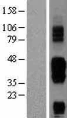 Western Blot: BTLA/CD272 Overexpression Lysate (Adult Normal) [NBP2-04442] Left-Empty vector transfected control cell lysate (HEK293 cell lysate); Right -Over-expression Lysate for BTLA/CD272.