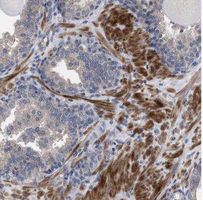 Immunohistochemistry-Paraffin BTN2A1 Antibody