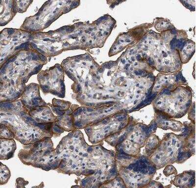 Immunohistochemistry-Paraffin BTN2A1 Antibody