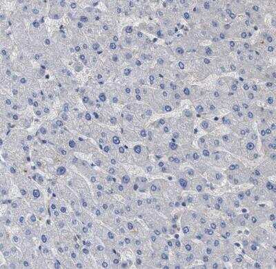 Immunohistochemistry-Paraffin: BTN2A1 Antibody [NBP1-88504] - Staining of human liver shows low positivity in hepatocytes as expected.