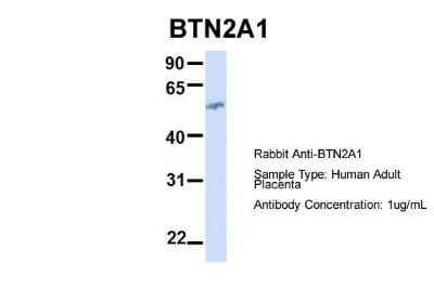 Western Blot: BTN2A1 Antibody [NBP1-62371] - Human Adult Placenta, Antibody Dilution: 1.0 ug/ml.