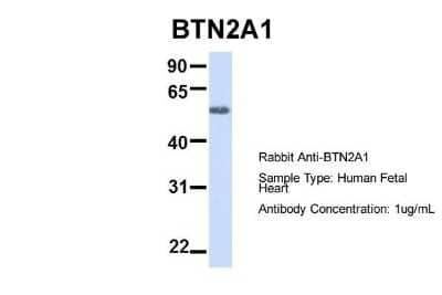 Western Blot BTN2A1 Antibody - BSA Free