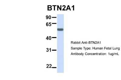 Western Blot: BTN2A1 Antibody [NBP1-62371] - Human Fetal Lung, Antibody Dilution: 1.0 ug/ml.