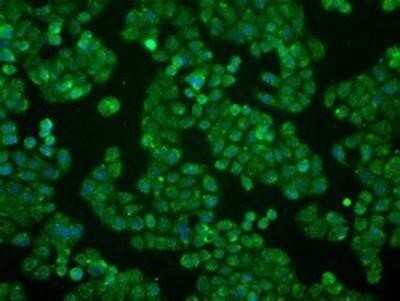 Immunocytochemistry/Immunofluorescence: BTN3A2 Antibody (OTI1A6) - Azide and BSA Free [NBP2-71678] - Staining of HT29 cells using anti-BTN3A2mouse monoclonal antibody.