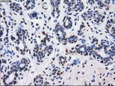 Immunohistochemistry: BTN3A2 Antibody (OTI1A6) - Azide and BSA Free [NBP2-71678] - Staining of paraffin-embedded breast tissue using anti-BTN3A2mouse monoclonal antibody.