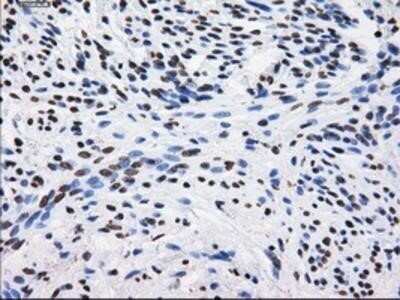 Immunohistochemistry: BTN3A2 Antibody (OTI1A6) - Azide and BSA Free [NBP2-71678] - Staining of paraffin-embedded endometrium tissue using anti-BTN3A2 mouse monoclonal antibody.