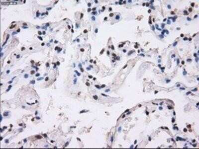 Immunohistochemistry: BTN3A2 Antibody (OTI1A6) - Azide and BSA Free [NBP2-71678] - Staining of paraffin-embedded lung tissue using anti-BTN3A2mouse monoclonal antibody.