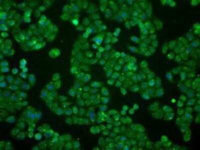 Immunocytochemistry/Immunofluorescence: BTN3A2 Antibody (OTI1A6) [NBP2-02151] - Immunofluorescent staining of HT29 cells using anti-BTN3A2mouse monoclonal antibody.