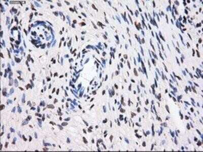 Immunohistochemistry-Paraffin: BTN3A2 Antibody (OTI1A6) [NBP2-02151] - Staining of paraffin-embedded Ovary tissue using anti-BTN3A2 mouse monoclonal antibody.