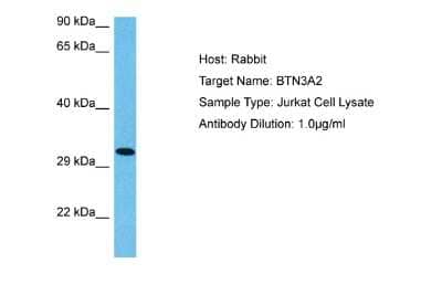 Western Blot: BTN3A2 Antibody [NBP2-86590] - Host: Rabbit. Target Name: BTN3A2. Sample Tissue: Human Jurkat Whole Cell lysates. Antibody Dilution: 1ug/ml