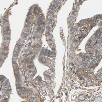 Immunohistochemistry-Paraffin BTN3A3 Antibody