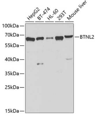 Western Blot: BTNL2/Butyrophilin-like 2 Antibody [NBP2-92488] - Analysis of extracts of various cell lines, using BTNL2/Butyrophilin-like 2 at 1:1000 dilution.Secondary antibody: HRP Goat Anti-Rabbit IgG (H+L) at 1:10000 dilution.Lysates/proteins: 25ug per lane.Blocking buffer: 3% nonfat dry milk in TBST.Detection: ECL Basic Kit .Exposure time: 10s.