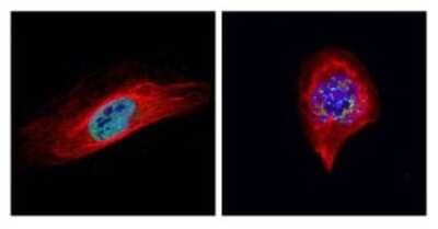 Immunocytochemistry/Immunofluorescence: BUB1 Antibody [NBP1-31584] - Paraformaldehyde-fixed U2OS, using BUB1 antibody (Geen) at 1:500 dilution. Alpha-tubulin filaments were labeled with an alpha Tubulin antibody (Red) at 1:2000.