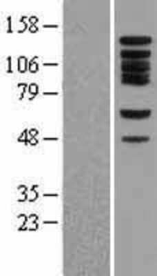 Western Blot: BUB1 Overexpression Lysate (Adult Normal) [NBL1-08056] Left-Empty vector transfected control cell lysate (HEK293 cell lysate); Right -Over-expression Lysate for BUB1.