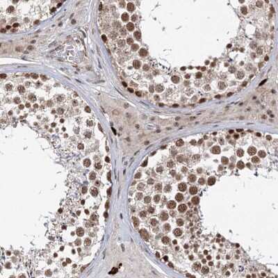 Immunohistochemistry: BUD13 Antibody [NBP2-38407] - Staining of human testis shows distinct nuclear positivity in cells in seminiferous ducts.
