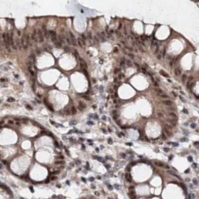 Immunohistochemistry-Paraffin: BUD13 Antibody [NBP1-81863] - Staining of human colon.