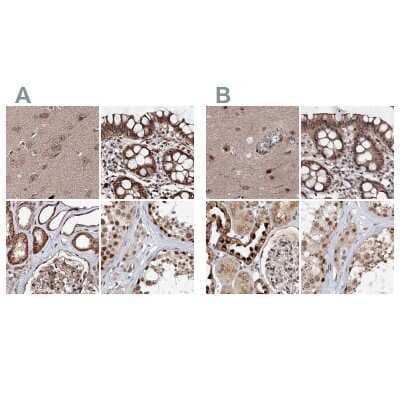 <b>Independent Antibodies Validation. </b>Immunohistochemistry-Paraffin: BUD13 Antibody [NBP2-38407] - Staining of human cerebral cortex, colon, kidney and testis using Anti-BUD13 antibody NBP2-38407 (A) shows similar protein distribution across tissues to independent antibody NBP1-81863 (B).