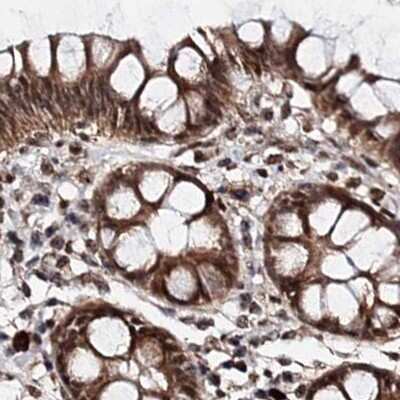 Immunohistochemistry-Paraffin: BUD13 Antibody [NBP2-38407] - Staining of human colon.