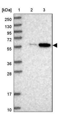 Western Blot: BUD13 Antibody [NBP1-81863] - Lane 1: Marker  [kDa] 250, 130, 95, 72, 55, 36, 28, 17, 10.  Lane 2: Human cell line RT-4.  Lane 3: Human cell line U-251MG sp