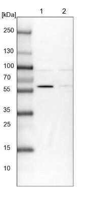 Western Blot: BUD13 Antibody [NBP1-81863] - Lane 1: NIH-3T3 cell lysate (Mouse embryonic fibroblast cells). Lane 2: NBT-II cell lysate (Rat Wistar bladder tumor cells).