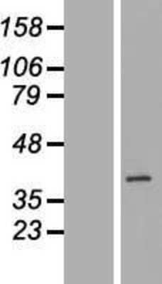Western Blot: BXDC1 Overexpression Lysate (Adult Normal) [NBL1-08061] Left-Empty vector transfected control cell lysate (HEK293 cell lysate); Right -Over-expression Lysate for BXDC1.