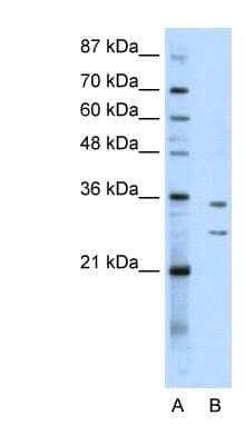 Western Blot: BXDC5 Antibody [NBP1-80467] - K562 cell lysate, Antibody Titration: 0.2-1 ug/ml