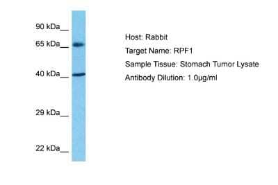 Western Blot: BXDC5 Antibody [NBP2-84528] - Host: Rabbit. Target Name: RPF1. Sample Type: Stomach Tumor lysates. Antibody Dilution: 1.0ug/ml