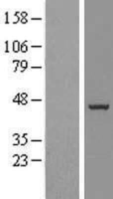 Western Blot: BXDC5 Overexpression Lysate (Adult Normal) [NBL1-08063] Left-Empty vector transfected control cell lysate (HEK293 cell lysate); Right -Over-expression Lysate for BXDC5.