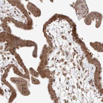 Immunohistochemistry-Paraffin: BYSL Antibody [NBP1-89500] - Staining of human placenta shows strong positivity in nucleoli in trophoblastic cells.