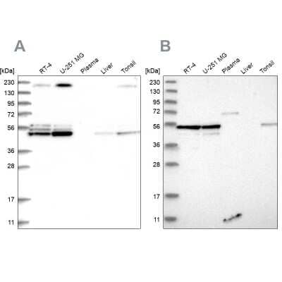 <b>Independent Antibodies Validation. </b>Western Blot: BYSL Antibody [NBP1-89500] - Analysis using Anti-BYSL antibody NBP1-89500 (A) shows similar pattern to independent antibody NBP1-89501 (B).