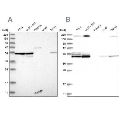 Western Blot BYSL Antibody